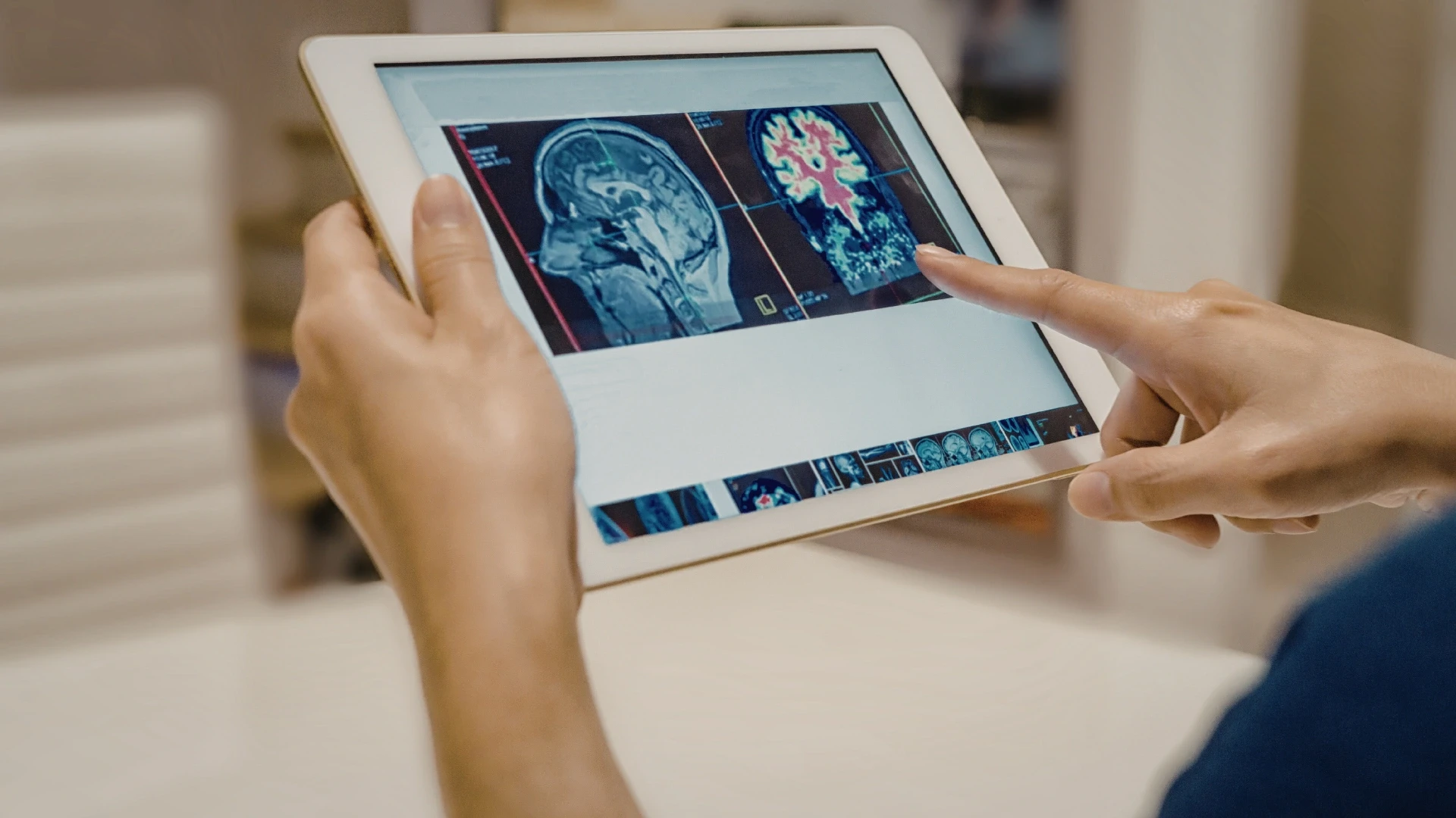 What Is AI Medical Image Analysis and Why Trust Is the Core Problem